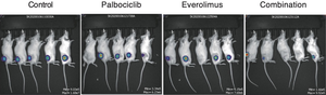 Effect of palbociclib on ATLL tumors in mice