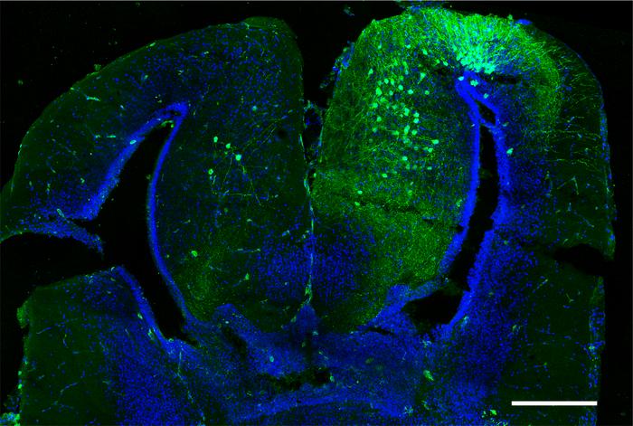 coronal section of the frog forebrain