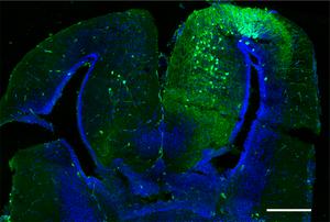 coronal section of the frog forebrain