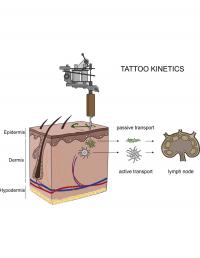 Translocation of Tattoo Particles from Skin to Lymph Nodes.