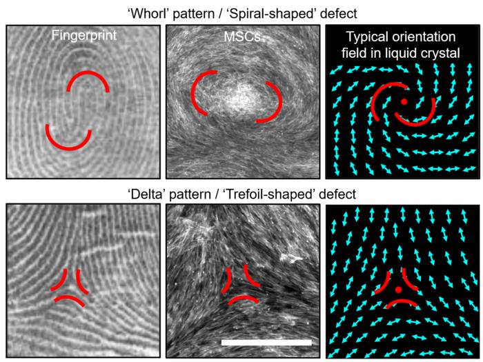 Self-assembled Mesenchymal Stromal Cells (MSCs) exhibit features similar to patterns observed in fingerprints and defects observed in liquid crystals.