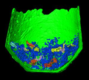 More than urns: A multi-method pipeline for analyzing cremation burials