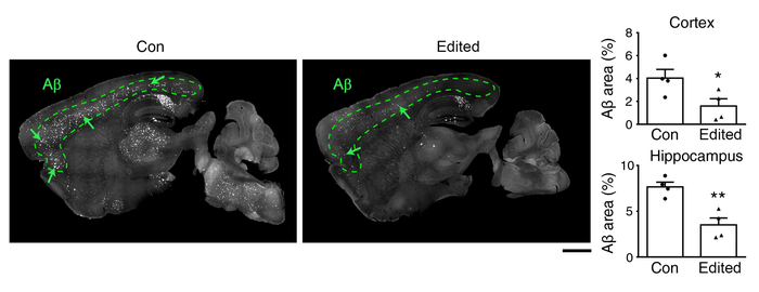 The level of amyloid