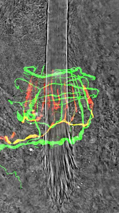 Protein Controls Touch Receptors (4 of 4)