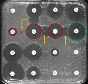 Kirby-Bauer disk diffusion test