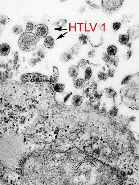 Prevalence of HTLV-1 Infection Among Teens And Adults in Gabon Remains High
