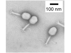 Clear image of T4-phase (virus particles contain head, tail, and six long tail fibers)