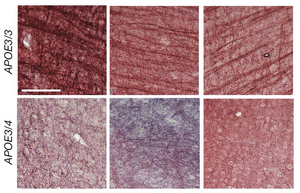 Reduced myelination  in APOE4 brain