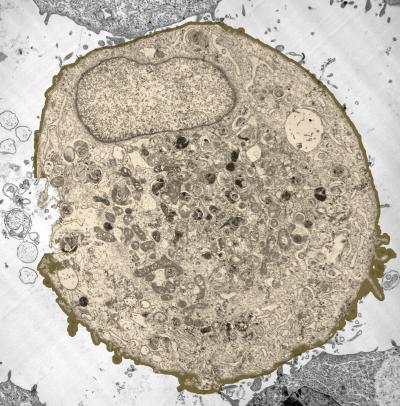 TEM Image Showing Membrane Gap