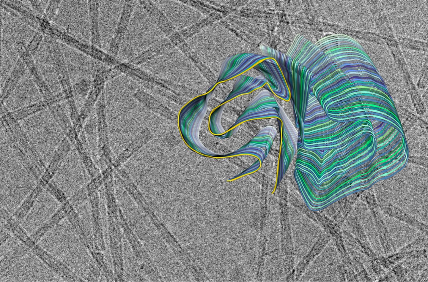 Amyloid Fibril