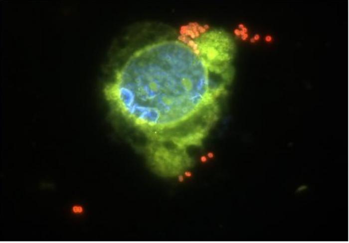Neisseria meningitidis bacteria (in red) binding to the surface of an epithelial cell (nucleus in blue) infected with influenza virus (viral neuraminidase in green). Influenza infection facilitates diplococci binding to the cell surface.