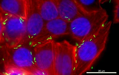 <i>Campylobacter jejuni</i>