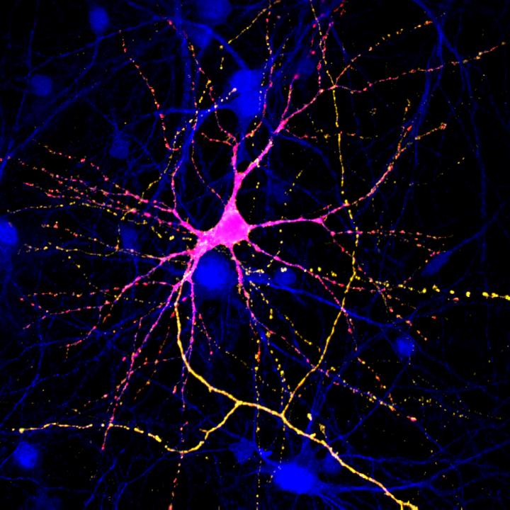 A Neuron Grown in a Dish