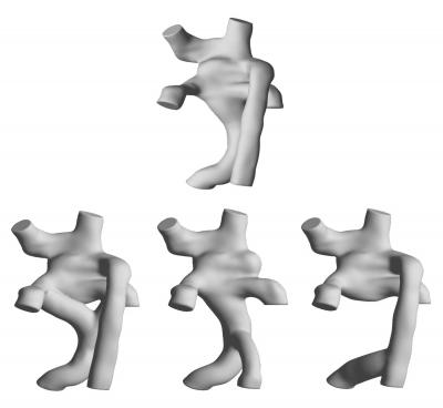 Pre-Surgical Anatomy