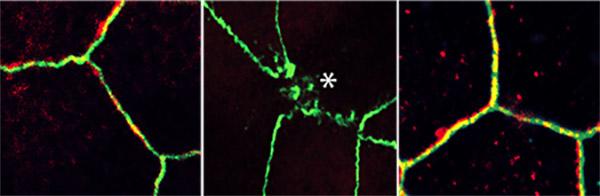 Metformin Acting on Gut Organoid, University of California San Diego