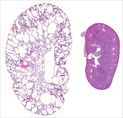 A Polycystic Mouse Kidney and a Normal Mouse Kidney