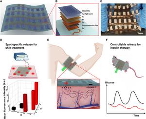 The baroreceptor-inspired MN skin patch.