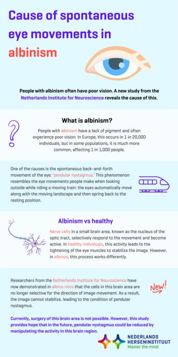 Cause of spontaneous eye movements in albinism