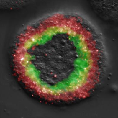 Gene Expression in a Sea Urchin Embryo