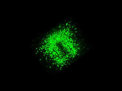 POMC neurons