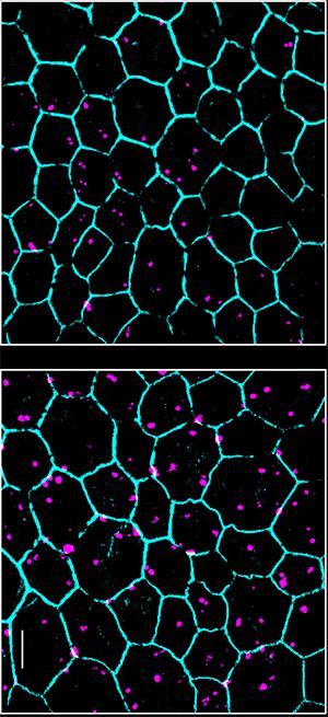 Photoreceptors