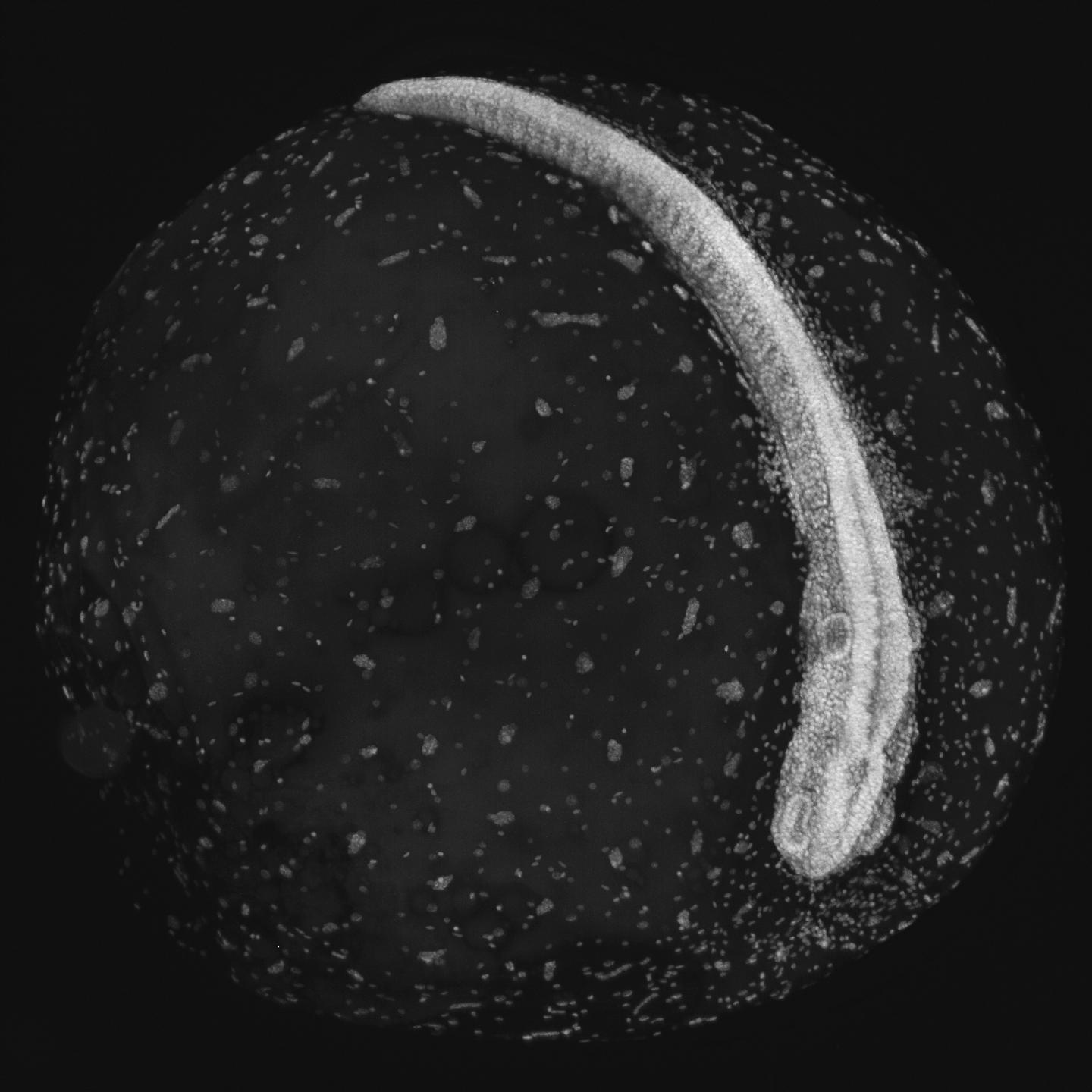 In Killifish: Diapause Protects Life From Normal Consequences of Aging (9 of 14)