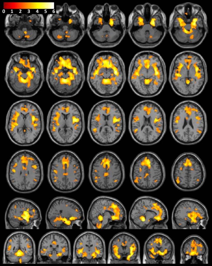 Brain Imaging (1 of 2)