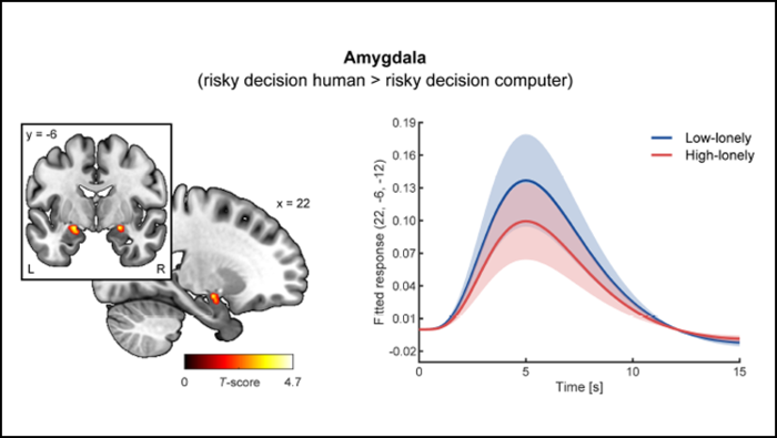 Loneliness Has a Different Neural Basis Than Social Anxiety