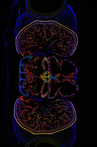 Octopus brain