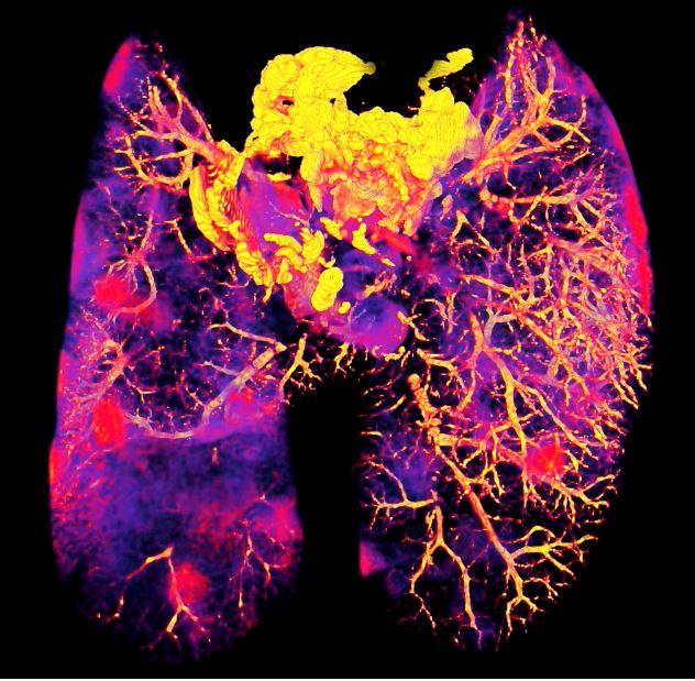 Mycobacterium tuberculosis infected Mouse lungs