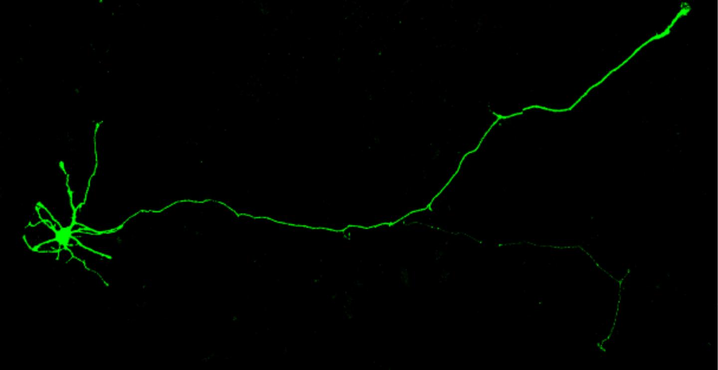 Induced Human Neuron