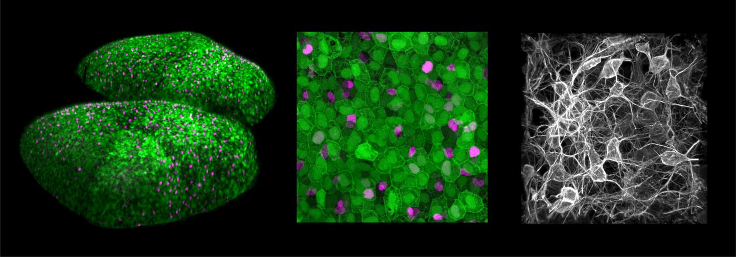 Intravital imaging of zebrafish neural stem cells over 23 days