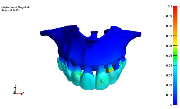 Digital twin of teeth and jaw