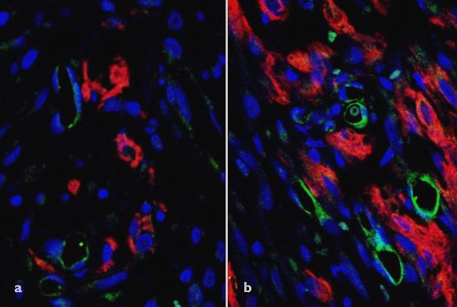 Microvascular Graft Comparison