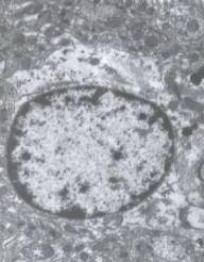 Alzheimer's Disease Rats 