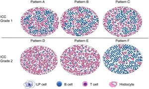 Schematic diagram of histopathologic patterns in NLP and relevant ICC grades