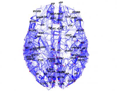 Brain Map