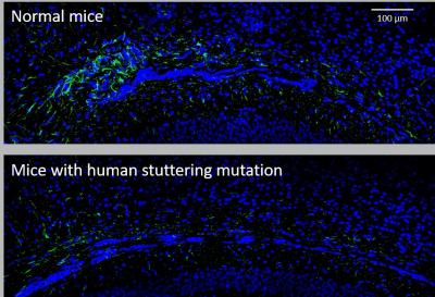 Astrocyte Loss in Mice with Human Stuttering Gene