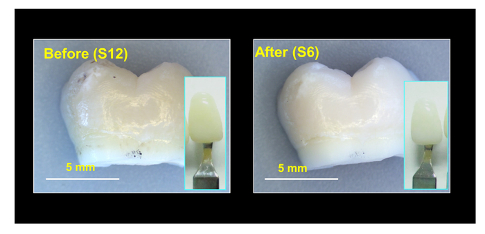 Whiter teeth, without the burn