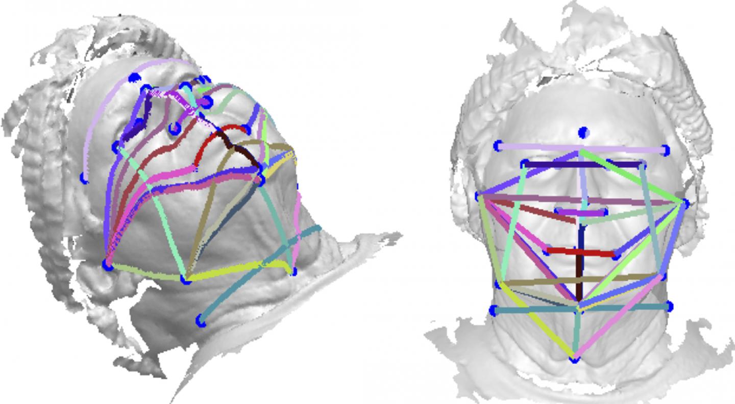 Predicting Sleep Apnea from 3D Face Photography