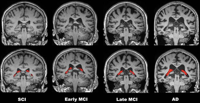 Brain MRI images.