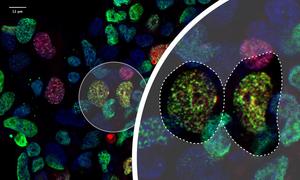 Ub-POD applied to the ubiquitin ligase RAD18 enables visualisation of UV-induced DNA damage repair hotspots in human cells