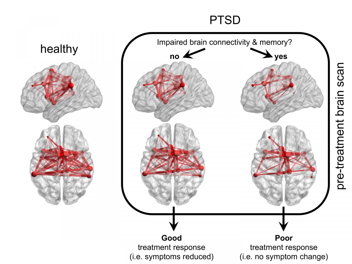 Unique Patterns of Brain Activity Predict Treatment Responses in Patients with PTSD (2 of 2)