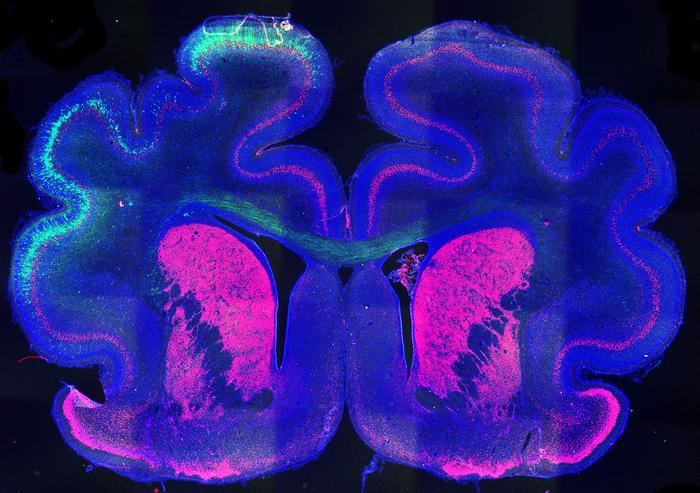 Image of a ferret brain showing the altered folding pattern (left) mediated by the Cux2 protein.