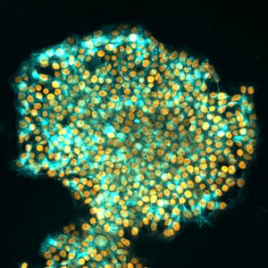 Human iPS cells