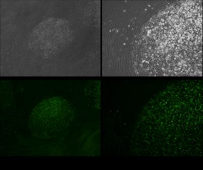 Induced Chondrogenic Cells (iChon Cells)