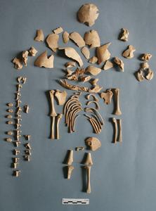 Ancient genomes reveal Down Syndrome in past - Vimarsana News