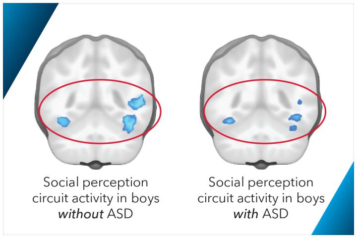 Brain Scans Showing Social Perception Circuit Activity in Boys