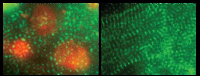 Stem Cell Derived Heart Cells