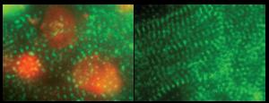 Stem Cell Derived Heart Cells